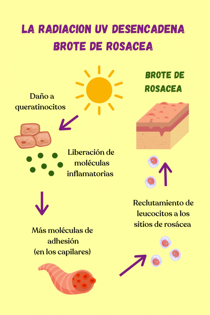 brote de rosacea