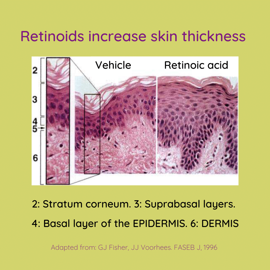 Histological section of the skin without treatment (vehicle) and upon treatment with 0.1% all-trans retinoic acid (tretinoin).