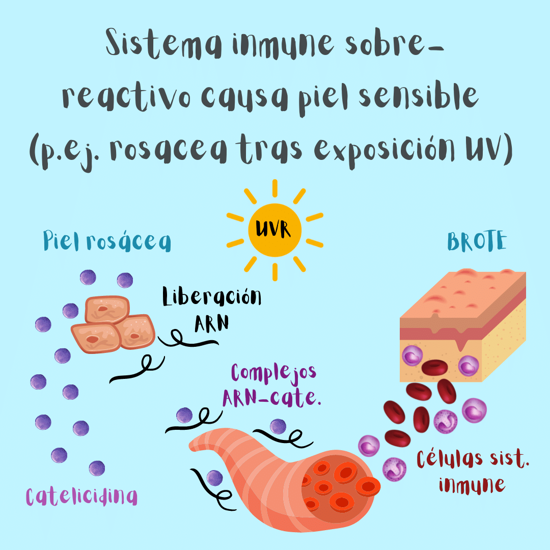 Un sistema inmune cutáneo demasiado reactivo puede causar piel sensible (se ilustra un brote de rosácea tras la exposición a la radiación ultravioleta del sol a modo de ejemplo).