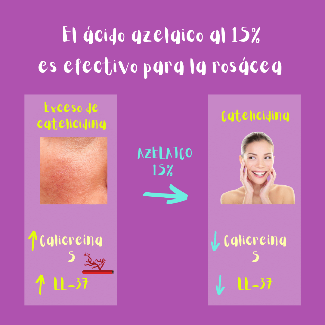 El ácido azelaico al 15% es efectivo para la rosácea: disminuye los niveles de actividad de calicreína 5 y del péptido LL-37 (derivado de catelicidina). Este último empeora la rosácea.