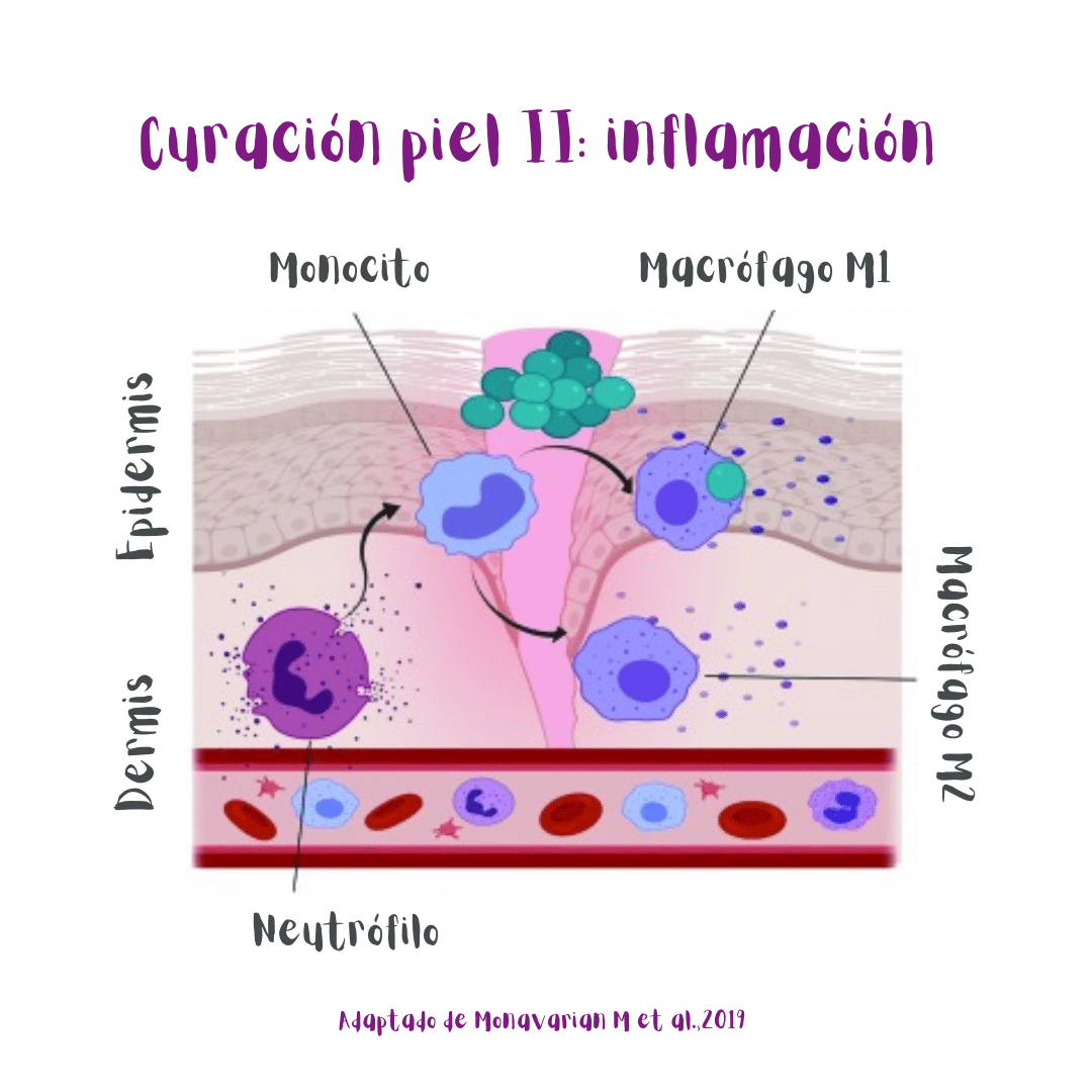 Segunda etapa de la curación de heridas en la piel: inflamación (ilustración). Los neutrófilos y macrófagos M1 se deshacen de bacterias y debris en la fase temprana de inflamación. Durante la fase tardía de la etapa de inflamación los macrófagos M2 secretan moléculas anti-inflamatorias.