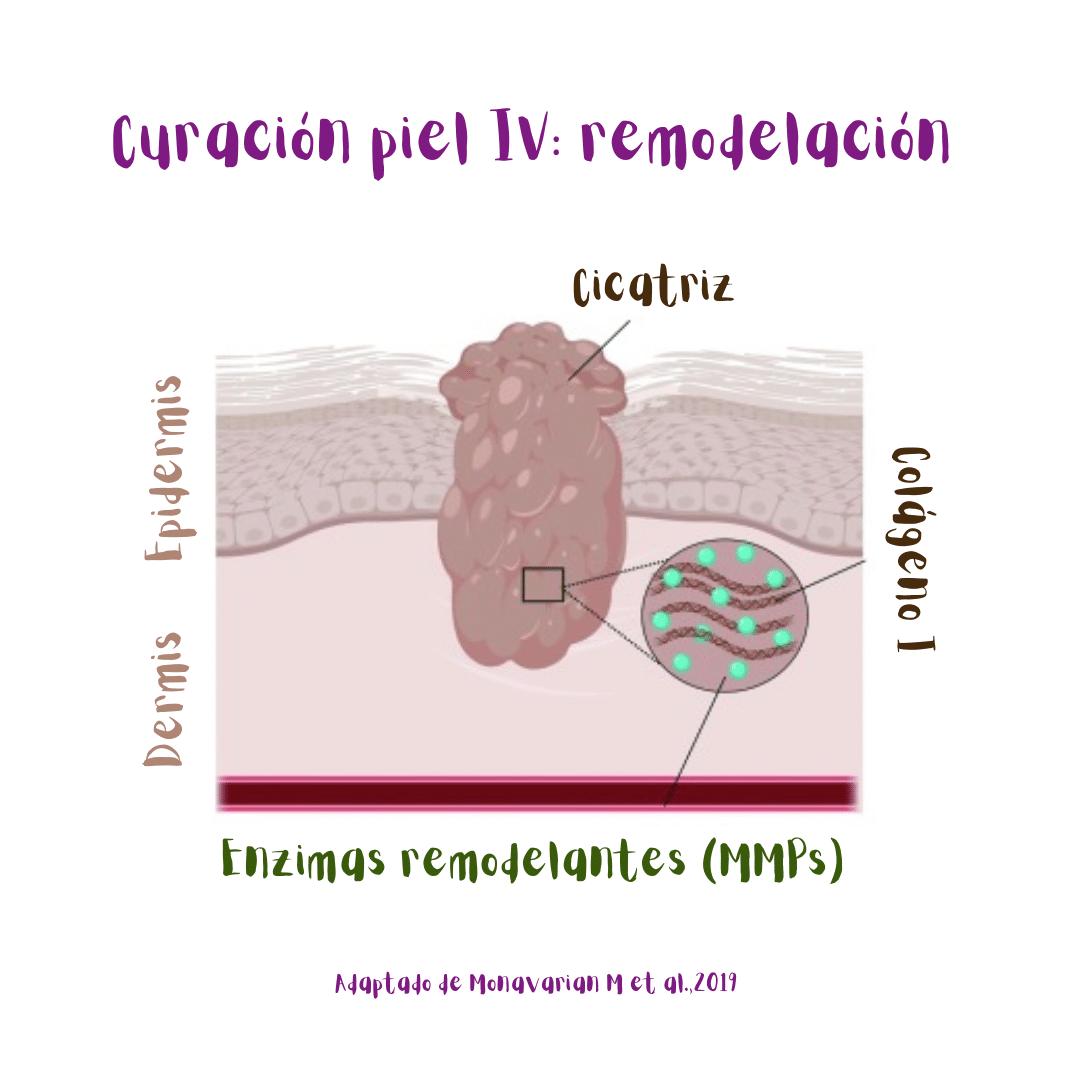 Etapa IV de la curación de heridas cutáneas: remodelación (ilustración). Enzimas remodelantes (MMPs) actúan en el sitio y el colágeno III es sustituído por el colágeno I, dando lugar a la cicatriz final.