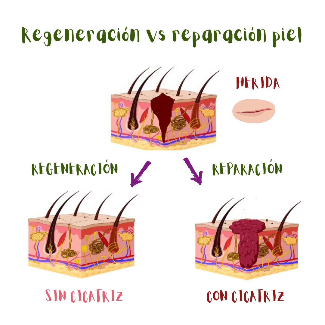 Regeneración versus reparación de heridas cutáneas (ilustración): la regeneración del tejido no genera cicatriz mientras que la reparación del mismo sí da lugar a una cicatriz.
