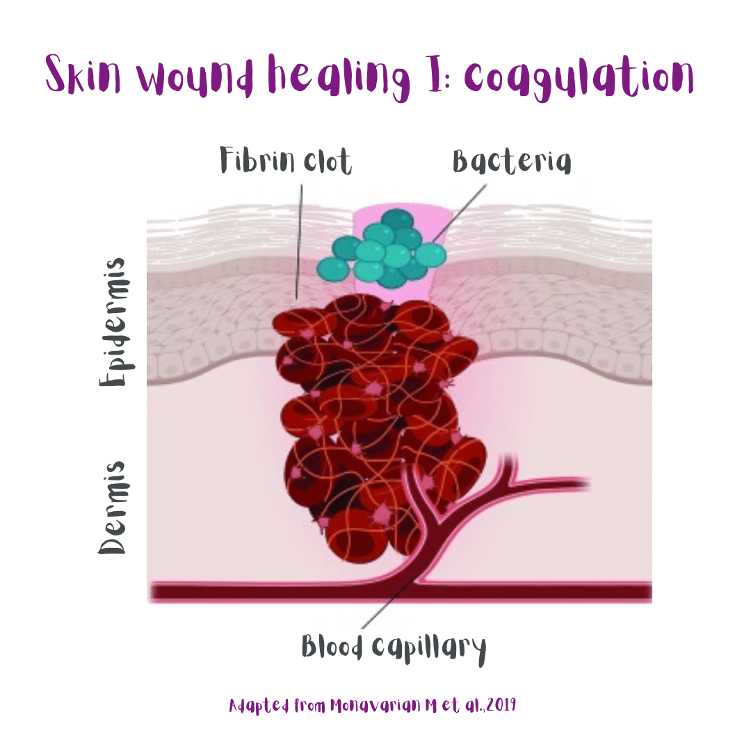 Skin wound healing step I: coagulation (illustration).