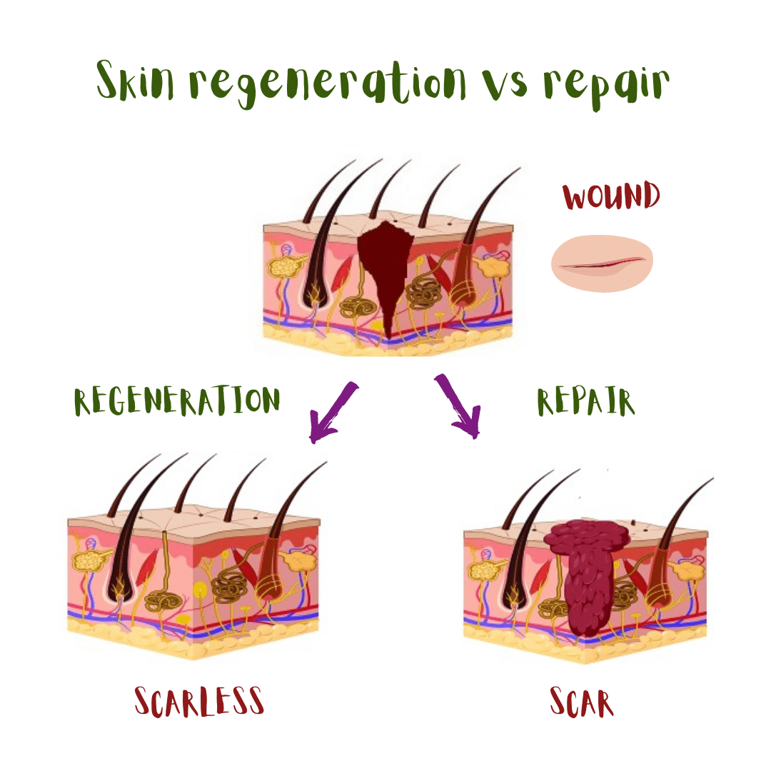 Skin regeneration versus repair (illustration): regeneration of the tissue results in scarless healing whereas tissue repair leads to the formation of a scar.