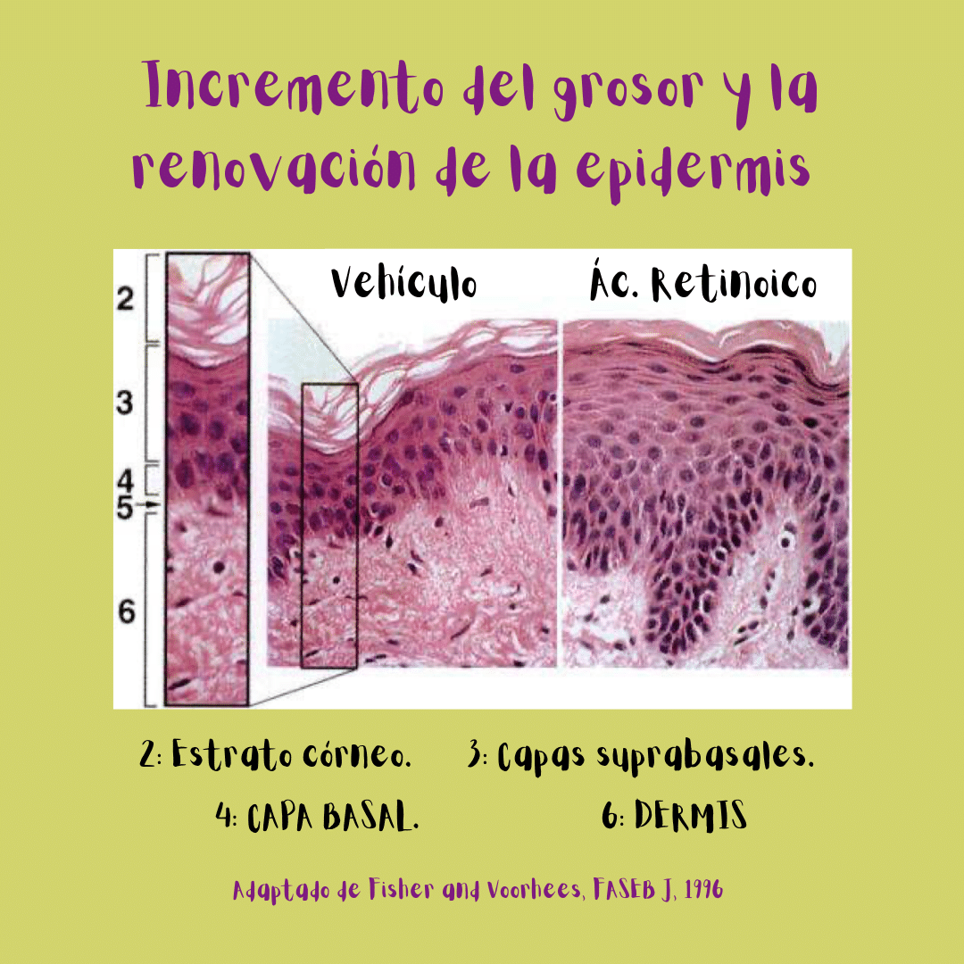 Foto de piel sin tratar y tratada con ácido retinoico: el ácido retinoico incrementa el grosor de la capa basal y el resto de la epidermis (que adquiere una morfología más compacta y ordenada).