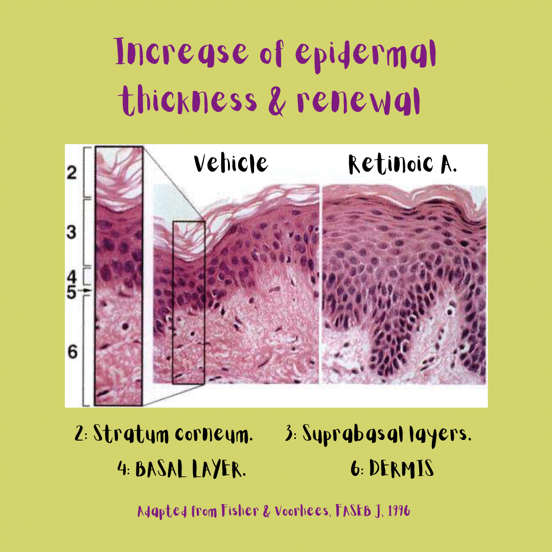 Photograph of skin without treatment versus skin treated with retinoic acid: retinoic acid increases the thickness of the basal layer and the rest of the epidermis (that acquires a more organized and compact morphology).