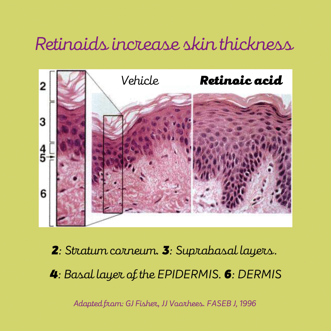 Histological cut of human skin: retinoids increase skin thickness.