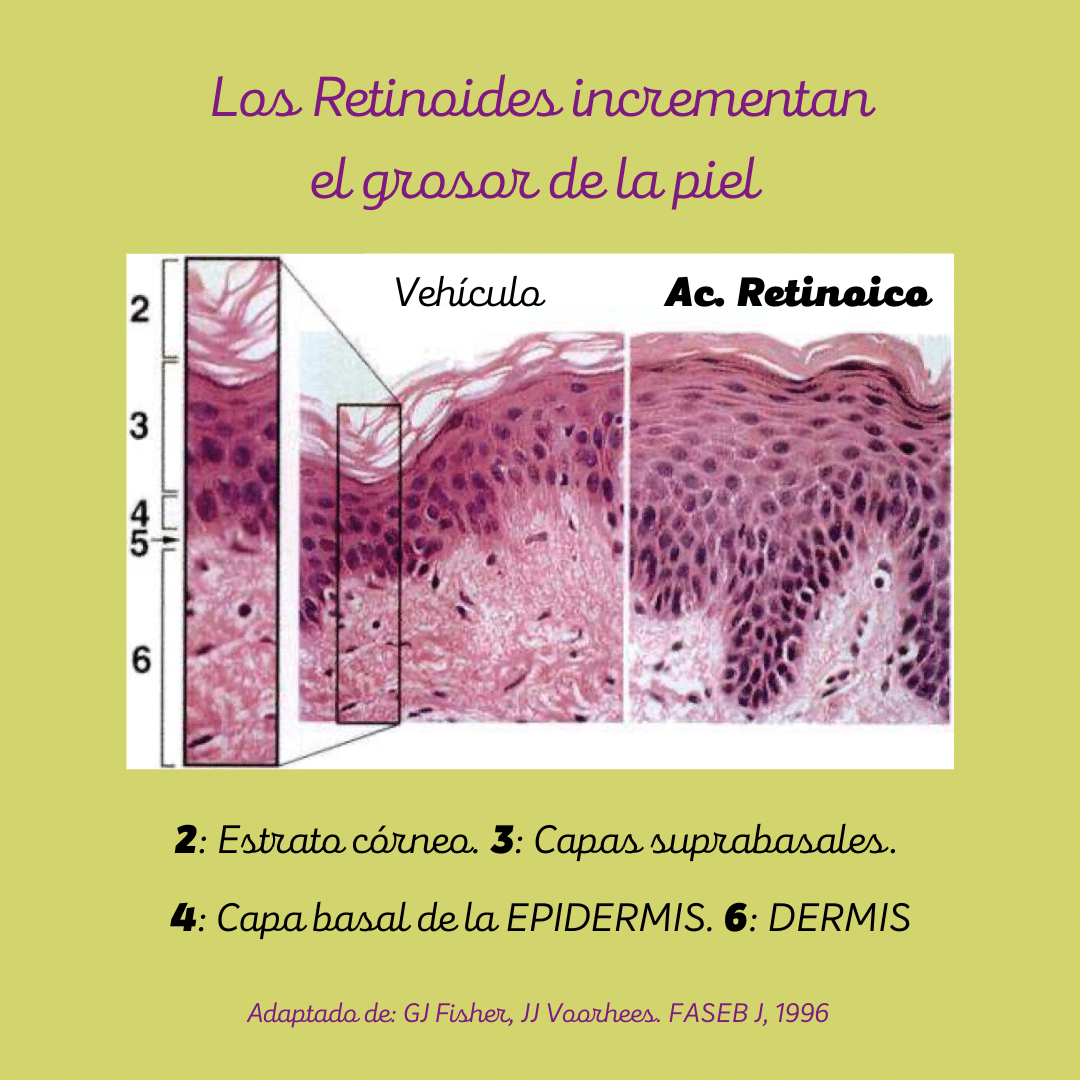 Corte histológico de piel humana: los retinoides incrementan su grosor.