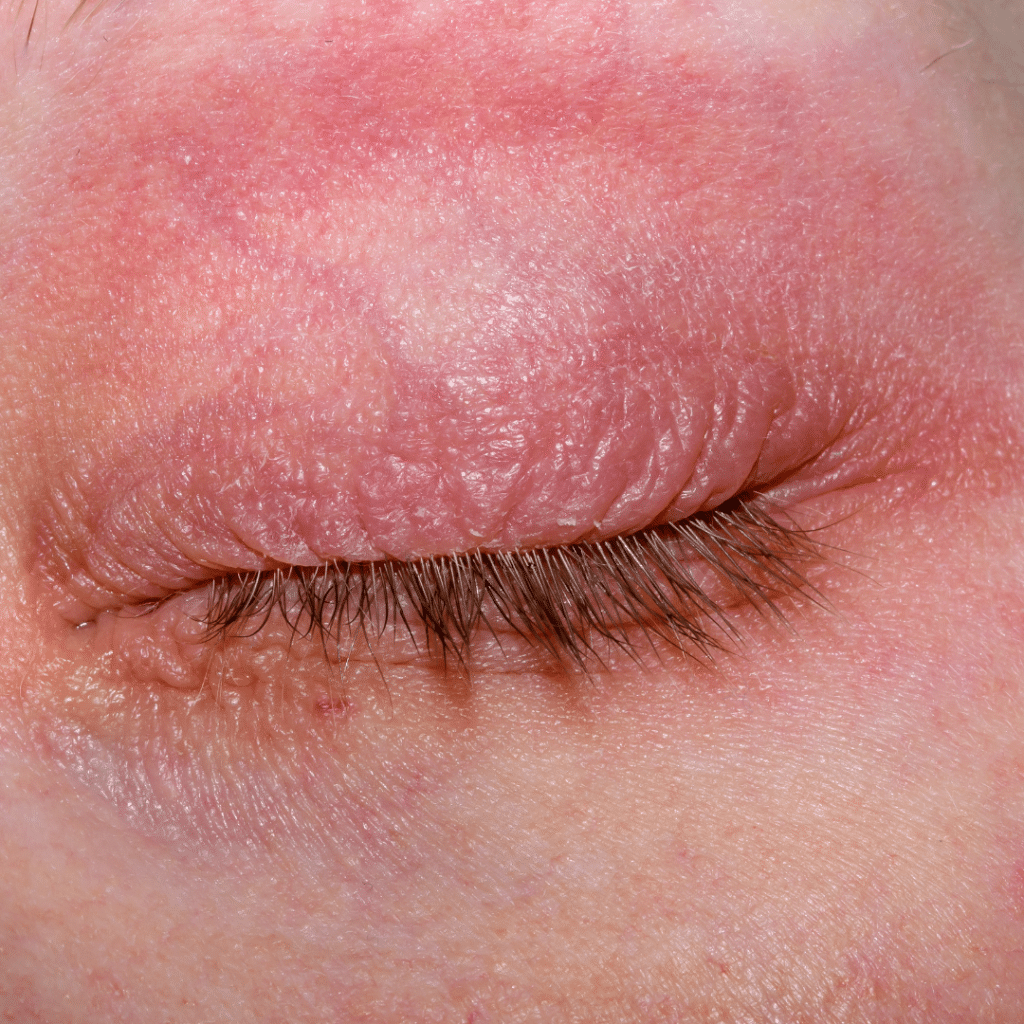 centella asiática propiedades piel