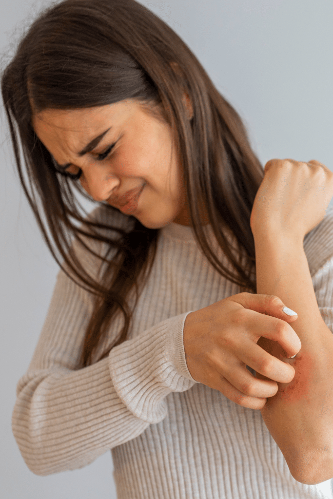 aloe vera antiinflamatorio