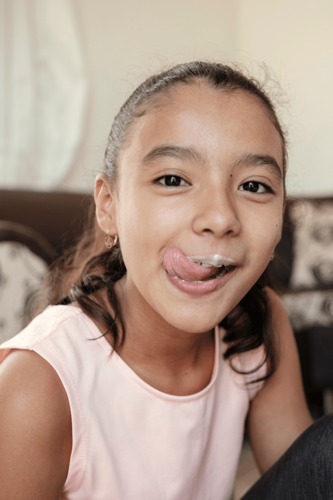 labios secos y agrietados