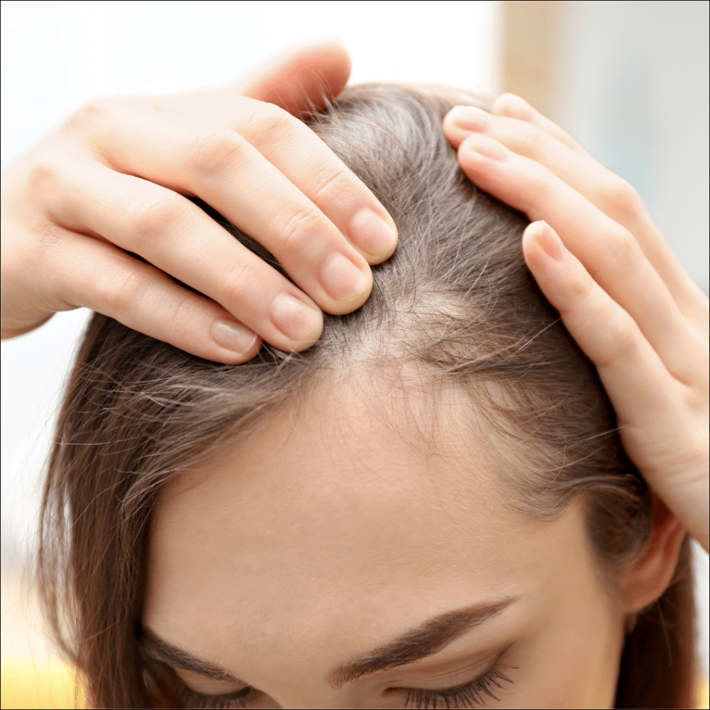 caida cabello the unlimited skin