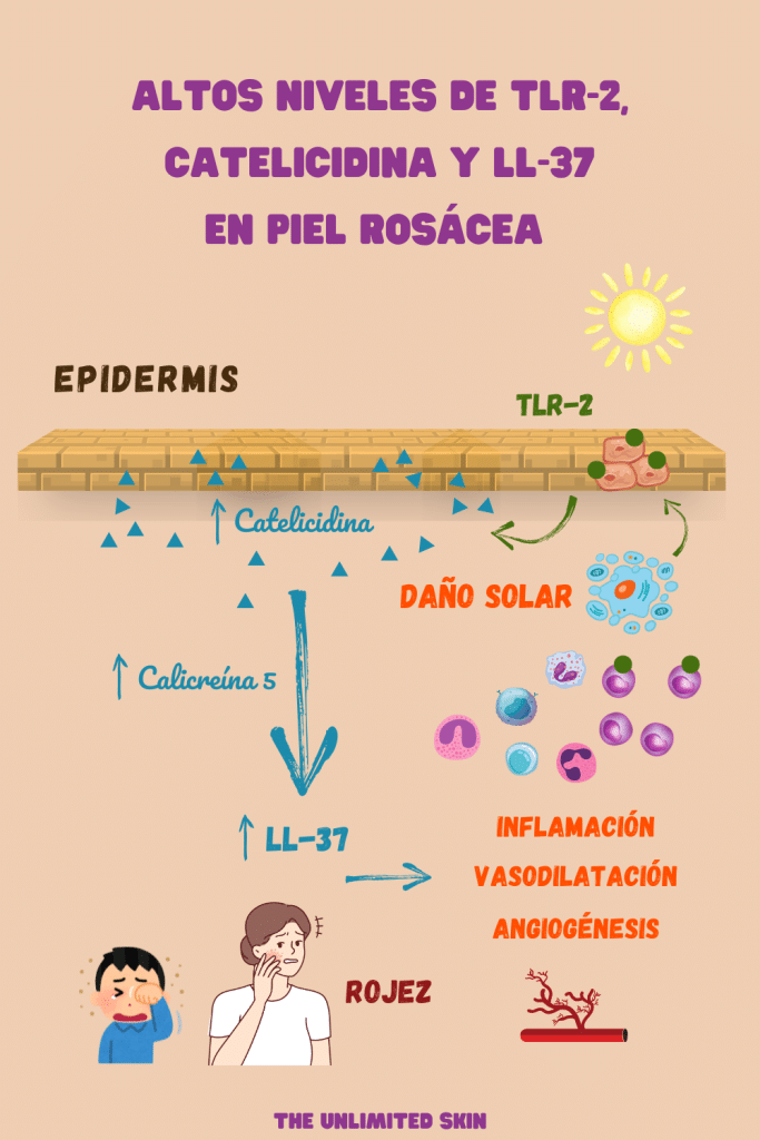 rosácea causas