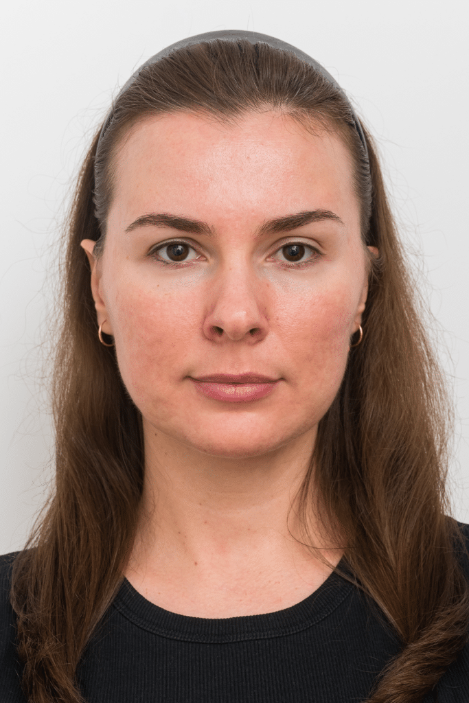 skincare rosacea