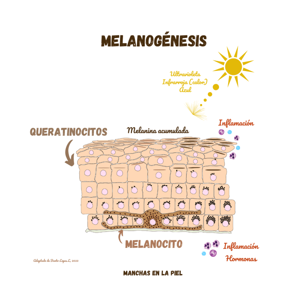 porque sale melasma en la cara