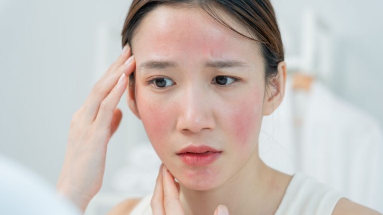probioticos topicos