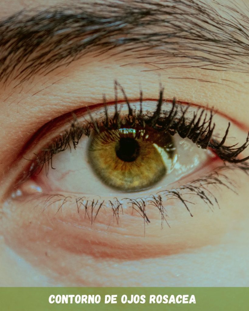 contorno de ojos rosacea