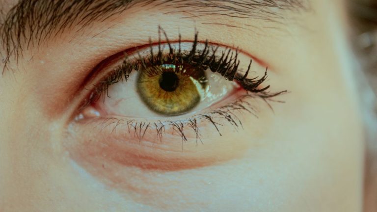 contorno de ojos rosacea