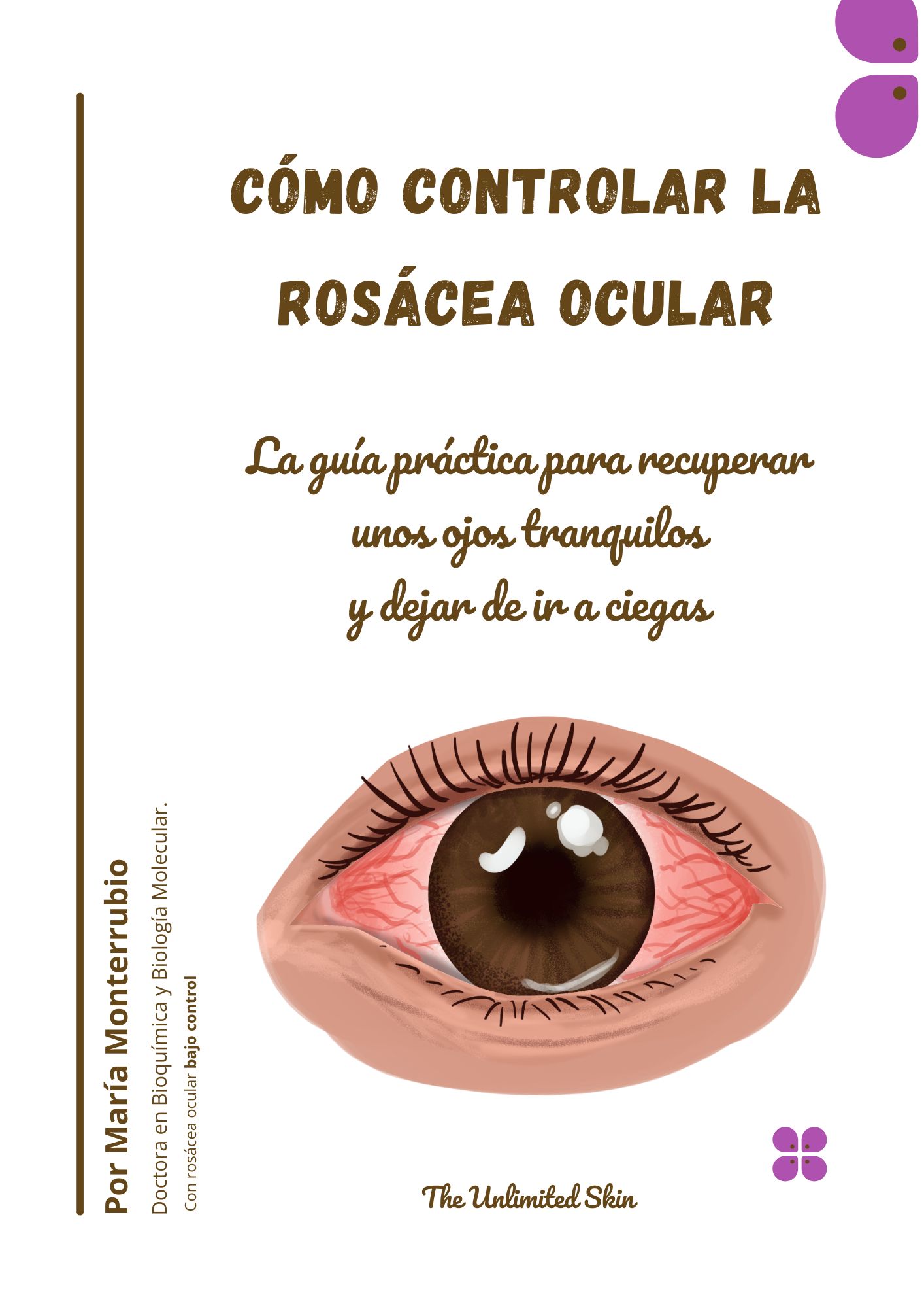 guía cómo controlar la rosácea ocular